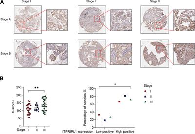 Development of a monoclonal antibody to ITPRIPL1 for immunohistochemical diagnosis of non-small cell lung cancers: accuracy and correlation with CD8+ T cell infiltration